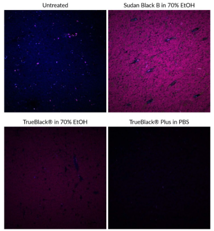 艾美捷TrueBlack Plus脂褐素自体荧光猝灭剂解决方案