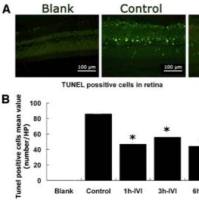 石蜡冰冻切片TUNEL凋亡荧光