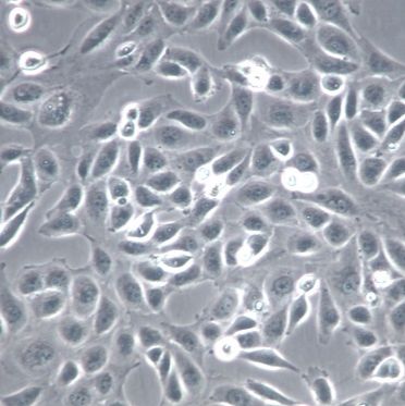【HK-2】HK-2细胞/HK-2细胞/HK-2人肾皮质近曲小管上皮细胞