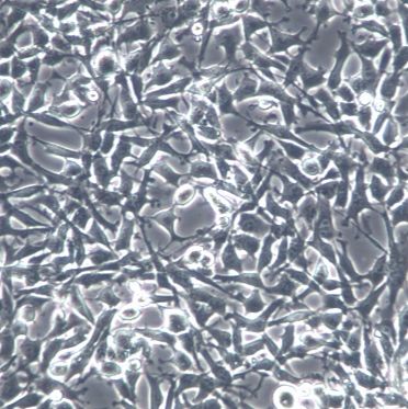【ES-2】ES-2细胞/ES-2细胞/ES-2人卵巢透明细胞癌细胞