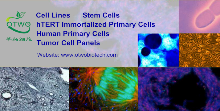 Jurkat人急性T淋巴细胞白血病细胞|Jurkat细胞|人