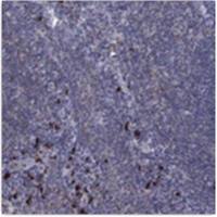 Atlas Antibodies HPA064739-S Anti-PVR 25ul