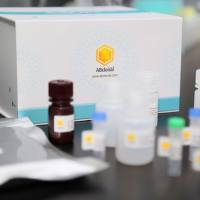 UBE2A Rabbit Polyclonal Antibody