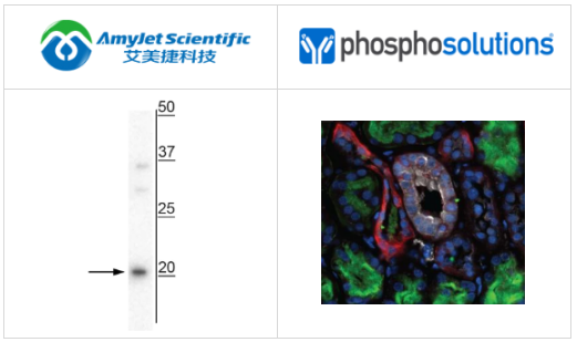 PhosphoSolutions抗加压素前原抗体解决方案 PhosphoSolutions抗加压素前原抗体解决方案