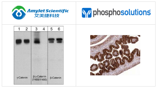 PhosphoSolutions抗β连环蛋白抗体(M118)解决方案 PhosphoSolutions抗β连环蛋白抗体(M118)解决方案
