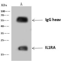 IL1RA 兔多抗 (抗原亲和纯化)