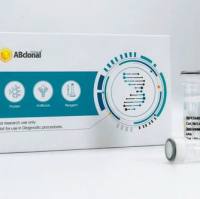 RRM1 Rabbit Polyclonal Antibody