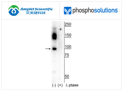 PhosphoSolutions抗CtIP(Ser326)抗体解决方案 PhosphoSolutions抗CtIP(Ser326)抗体解决方案