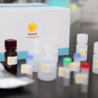 TBRG4 Rabbit Polyclonal Antibody