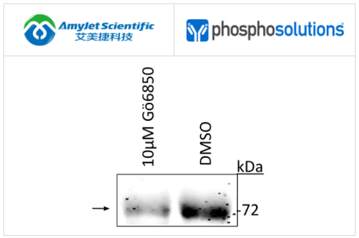PhosphoSolutions抗ATF2(Thr52)抗体解决方案 PhosphoSolutions抗ATF2(Thr52)抗体解决方案