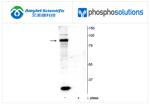 PhosphoSolutions抗ATRIP(Ser239)抗体解决方案 PhosphoSolutions抗ATRIP(Ser239)抗体解决方案