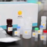 FBXW5 Rabbit Polyclonal Antibody