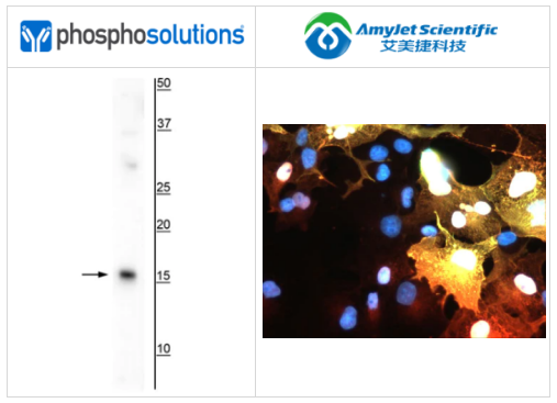 PhosphoSolutions抗AIF1/Iba1抗体解决方案 PhosphoSolutions抗AIF1/Iba1抗体解决方案