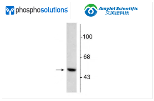 PhosphoSolutions抗多巴脱羧酶抗体解决方案 PhosphoSolutions抗多巴脱羧酶抗体解决方案