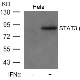 STAT3(Phospho-Tyr705) Antibody