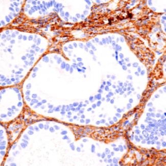 17羟孕酮抗体(17OH PROG)