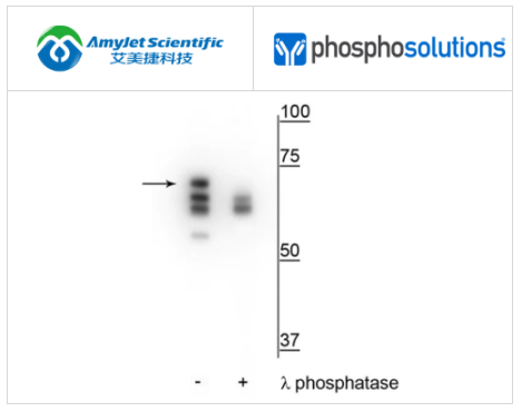 PhosphoSolutions抗Hsp70（Ser153）抗体解决方案 