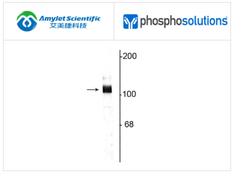 PhosphoSolutions抗淀粉样前体蛋白抗体解决方案