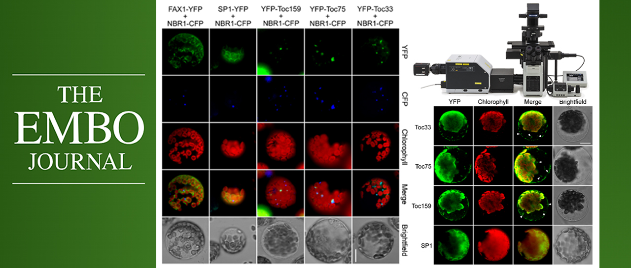 科技前沿 | SpinSR助力揭示选择性自噬调控叶绿体转蛋白转运并调控植物逆境响应的新机制