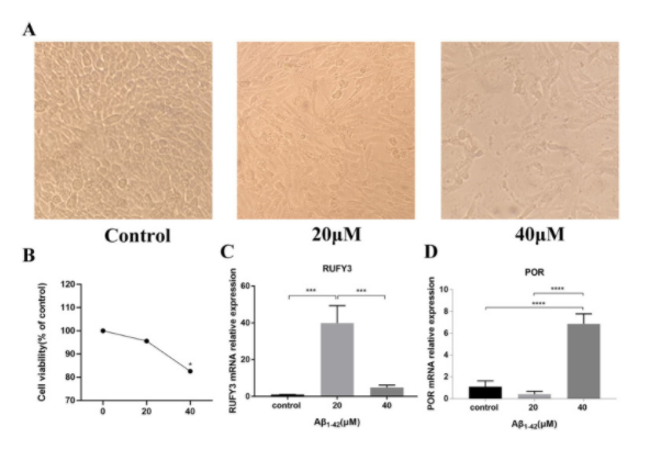 β-Amyloid (1-42)human TFA