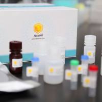 MKL1 Rabbit Polyclonal Antibody