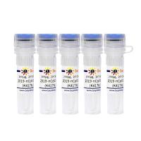 2019-nCoV Spike Protein RBD (K417N, E484K, N501Y)