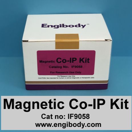 磁珠法CoIP kit免疫共沉淀试剂盒限时大特价800元