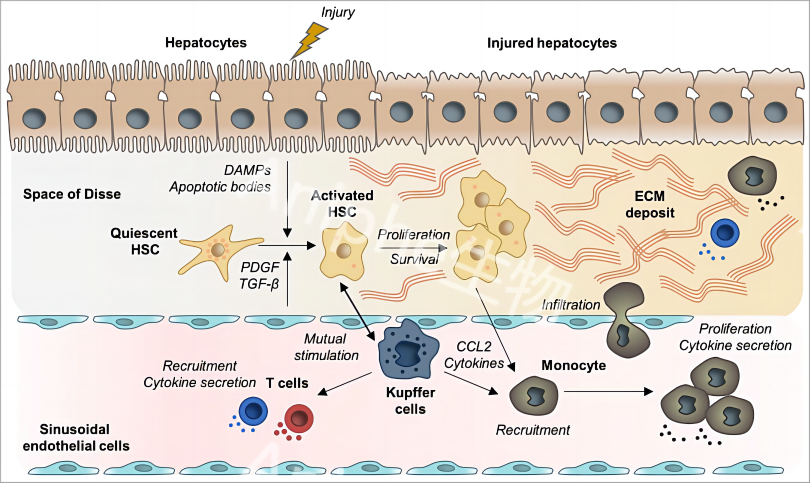 疾病模型 | 肝纤维化(HF)与肝纤维化肝癌（HCC）（上）