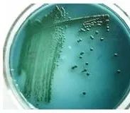 常见微生物菌落形态图及比较