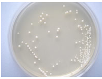 常见微生物菌落形态图及比较