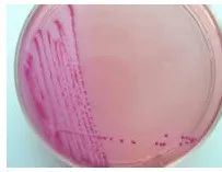 常见微生物菌落形态图及比较