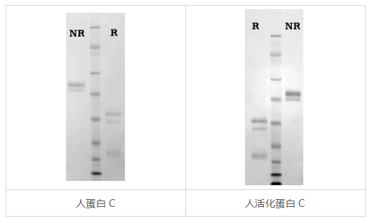 艾美捷蛋白C&活化蛋白C解决方案 艾美捷蛋白C&活化蛋白C解决方案