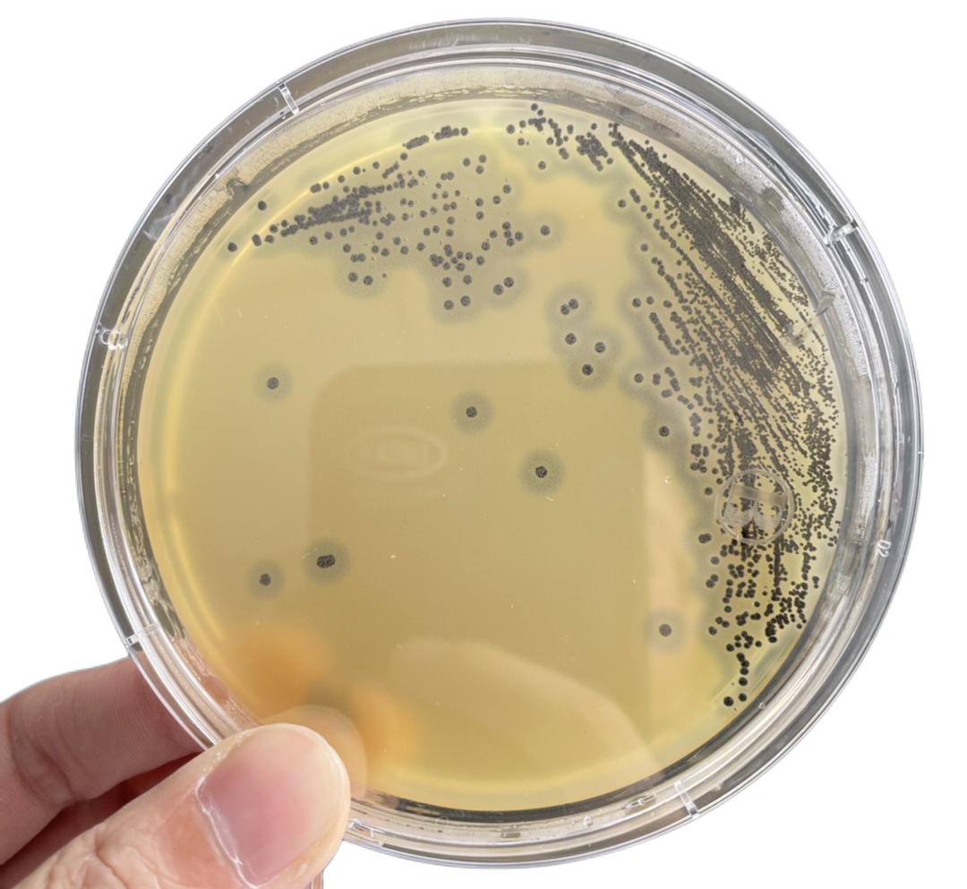 常见微生物菌落形态图及比较