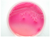 常见微生物菌落形态图及比较