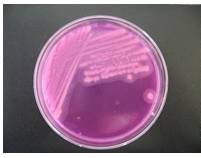 常见微生物菌落形态图及比较