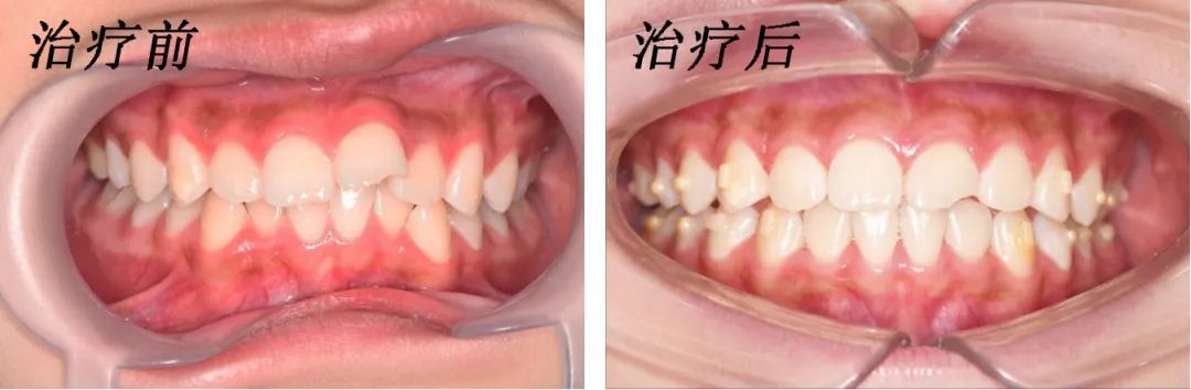 这个暑假，漳州家长都在做这件事！！！