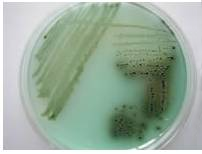 常见微生物菌落形态图及比较