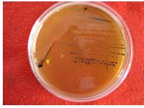 常见微生物菌落形态图及比较