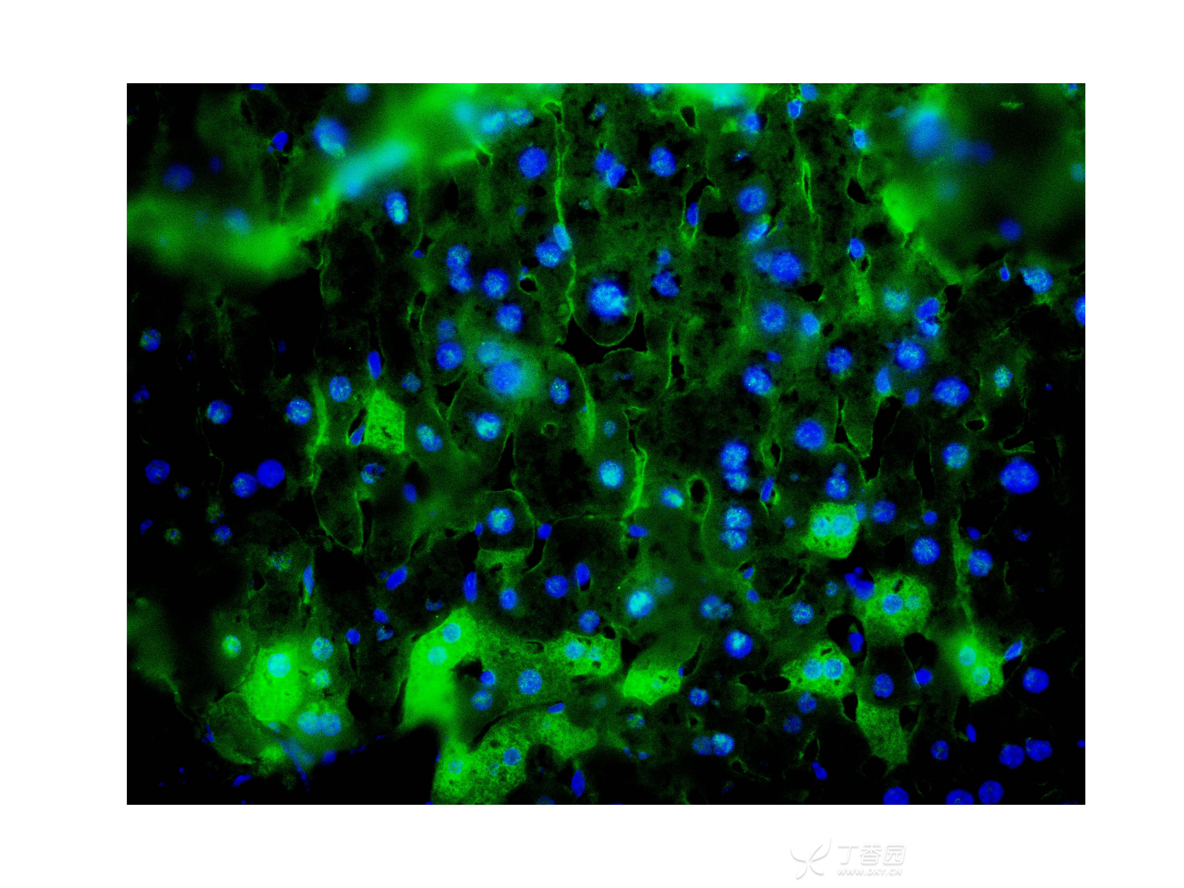 肝组织巨噬细胞免疫荧光