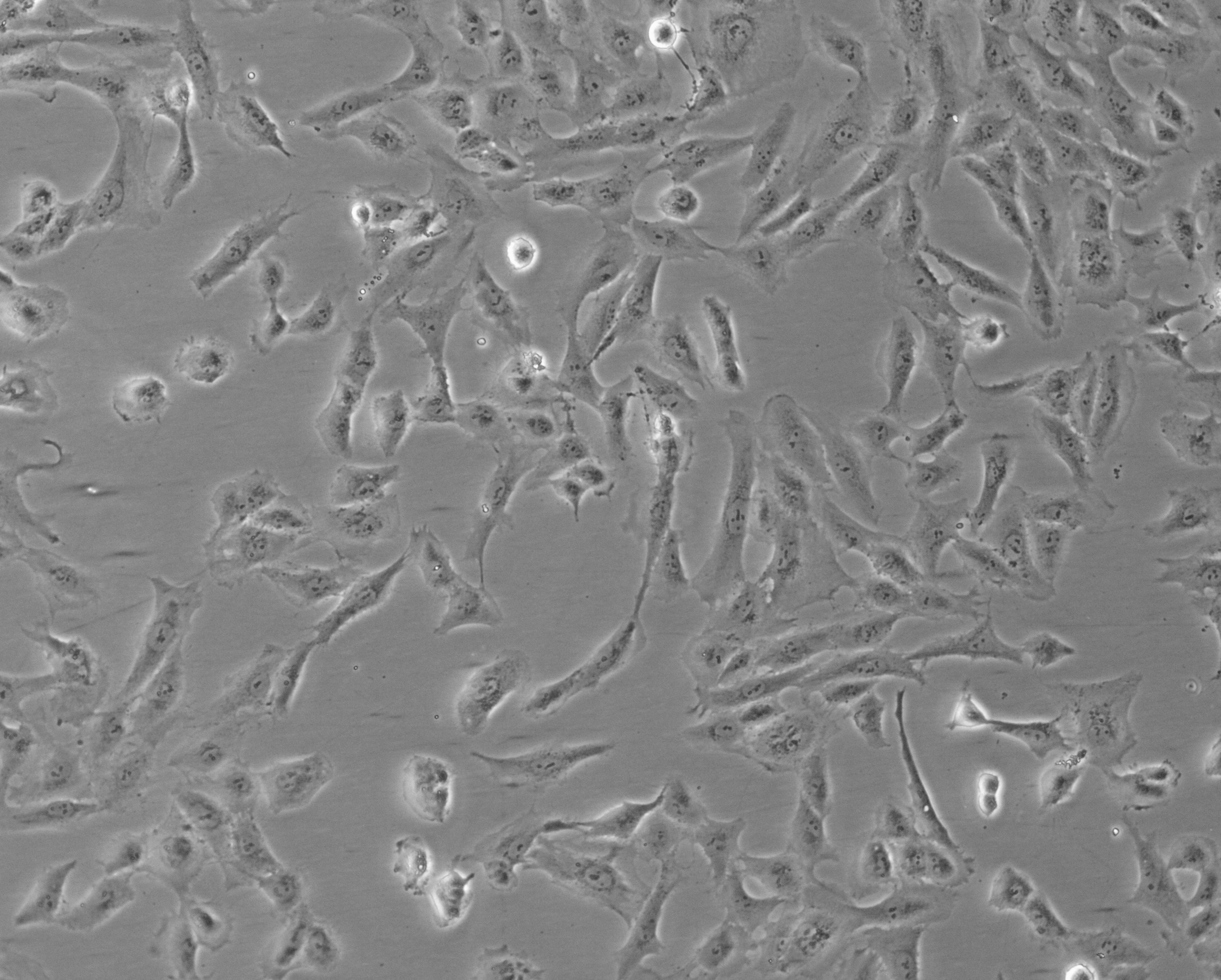 细胞攻略 | SW1353(人软骨肉瘤细胞)细胞培养教程