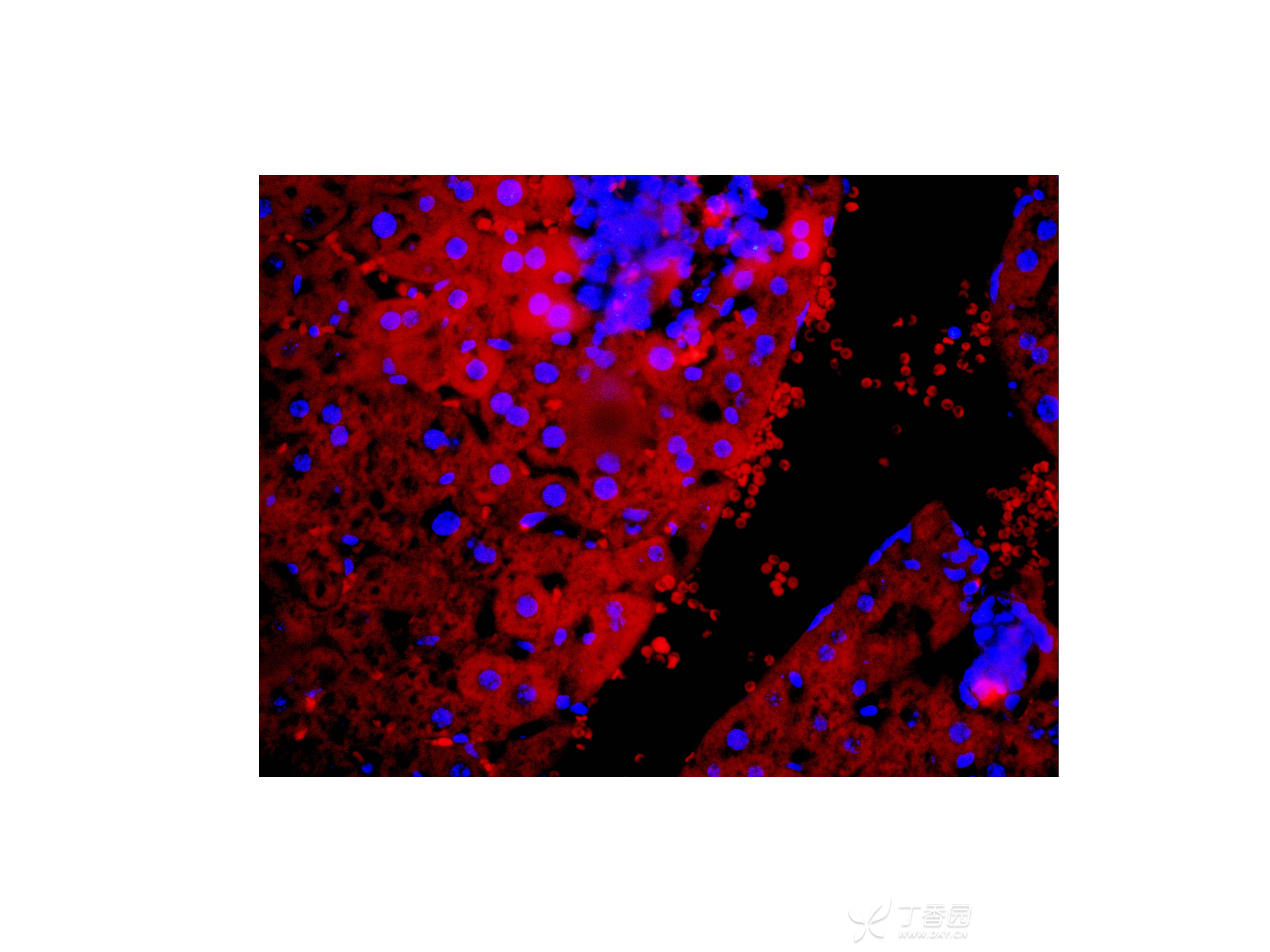 肝组织巨噬细胞免疫荧光