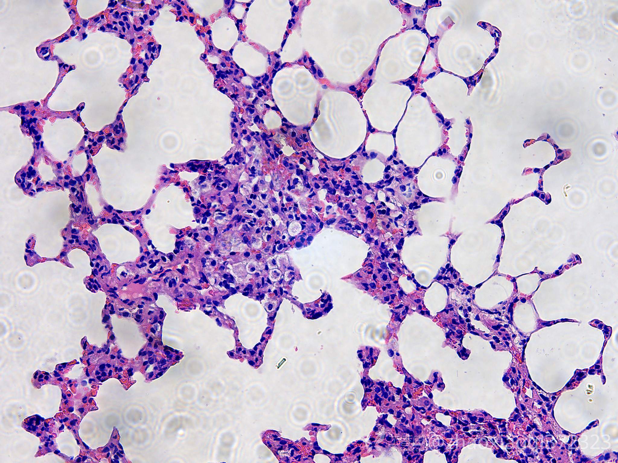 请问此大鼠肺脏he病理情况