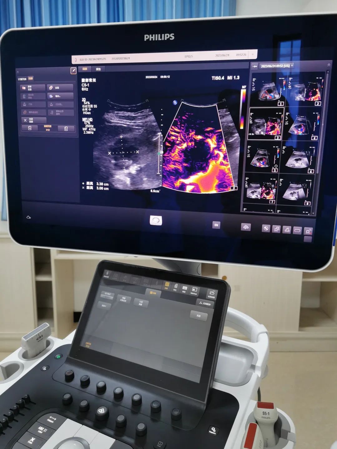 家礼医院引进多模态介入超声射频及微波治疗系统：开启超微创肿瘤治疗模式