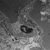透射电镜实验服务