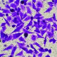 生物细胞培养迁移侵袭MTT转染流式分选诱导整体课题实验服务