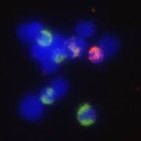 免疫荧光(石蜡-三标)