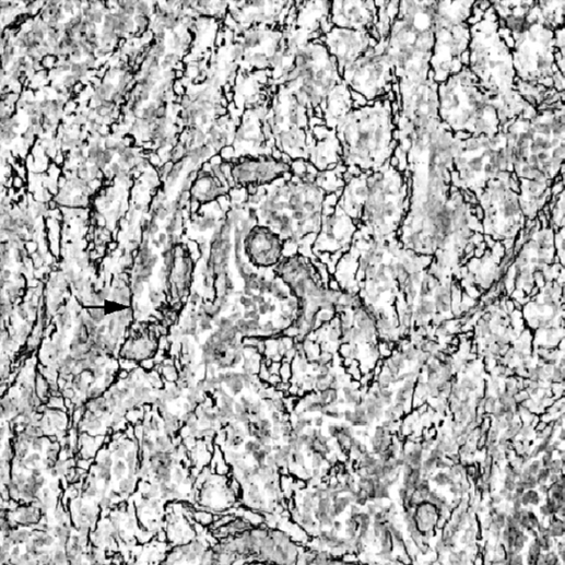 网状纤维染色银染实验服务