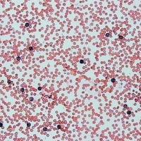 碱性磷酸酶染色