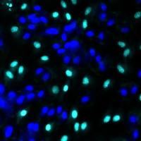 细胞、组织TUNEL凋亡染色实验服务