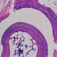 骨组织脱钙(大/小)
